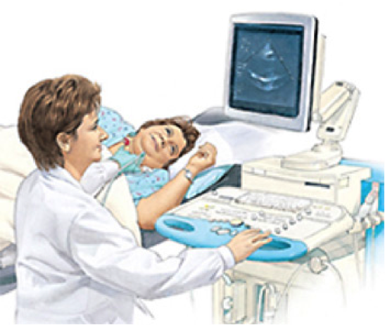 Echocardiogram Image